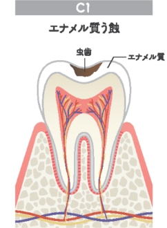C1