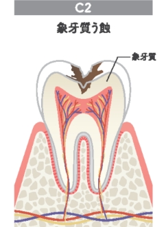 C2（中期）
