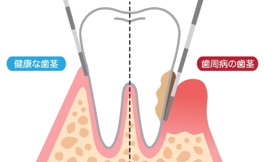 検査（診断）